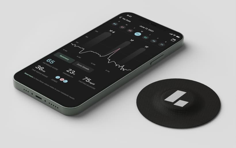 Continuous Glucose Monitor